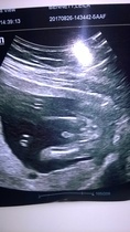 gender scan at 17 weeks...girl or boy...i think im in denial!?!?!?