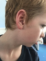 What are these bites/rashes/something???