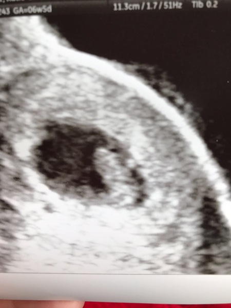 Babies due in April 2018