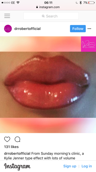 Best London Botox for a newbie?