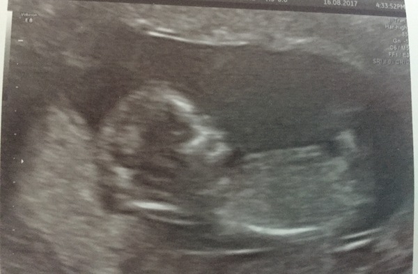 Gender guess?