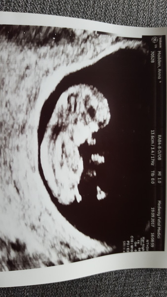 Pregnancies due April 2018 *Edited by MNHQ*