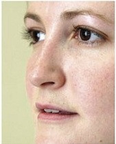 So I have booked in to have lip filler :terrified: