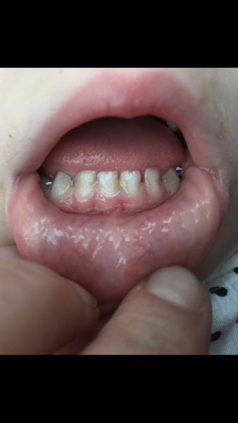 AIBU to doubt butcher dentist?