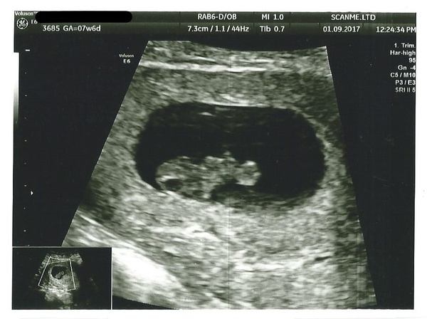 Pregnancies due April 2018 *Edited by MNHQ*