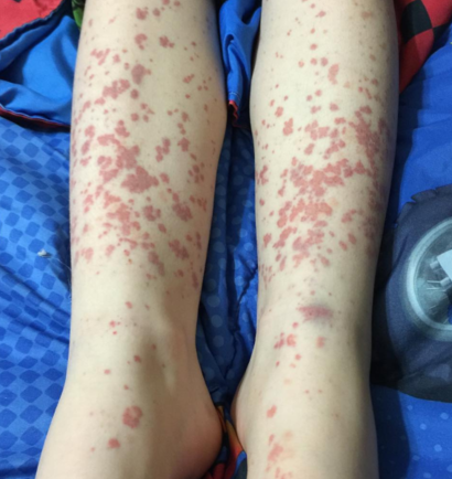 Emergency GP appointment or A&E??? Pic included