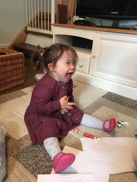 Down Syndrome Diagnosis