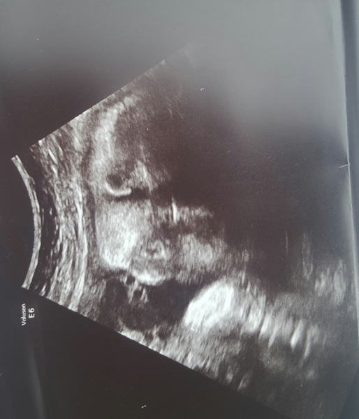 First Time Pregnancy (4)