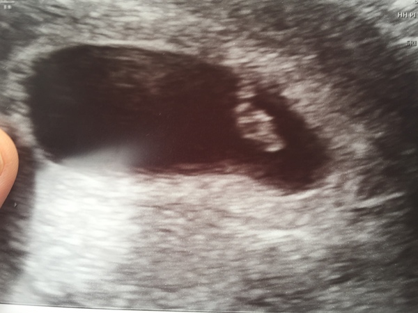 Pregnancies due April 2018 *Edited by MNHQ*