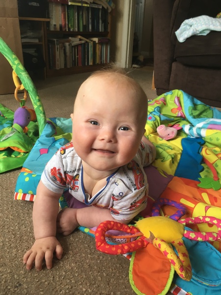 Down Syndrome Diagnosis