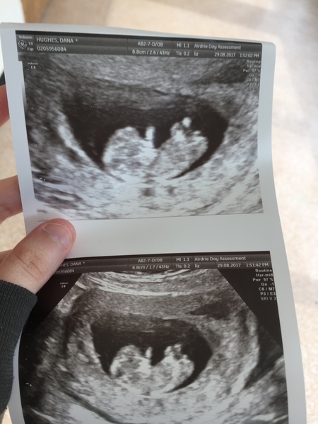 Scan pic