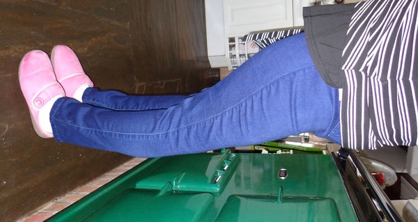Joint Hypermobility