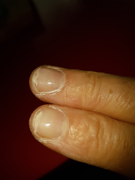 Help! What can I do with these nails?
