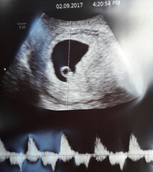 Babies due in April 2018