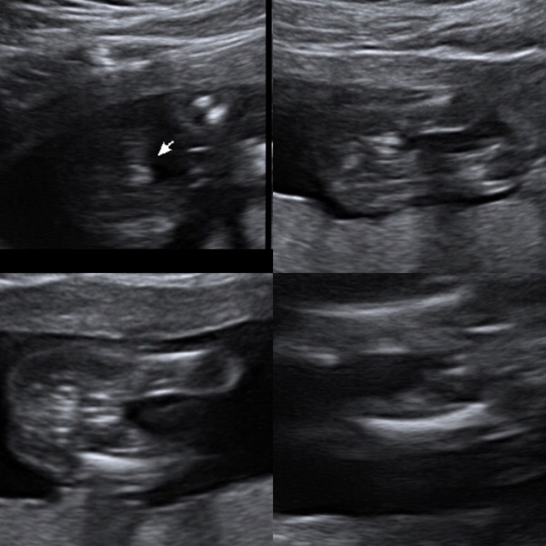 Not sure on gender!!!!