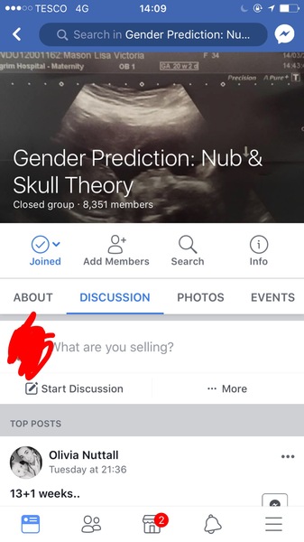 Any sonographer or nub experts please