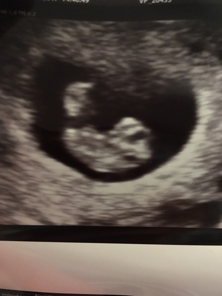 Pregnancies due April 2018 *Edited by MNHQ*
