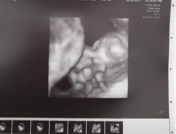 Babies due in April 2018