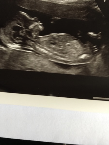 Gender guesses with nub theory?