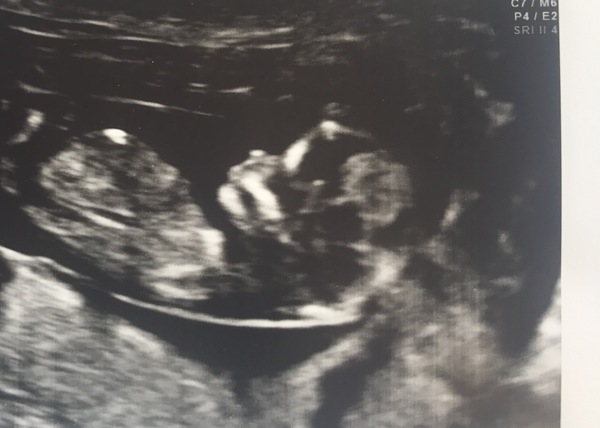 Thread no.2 for babies due April 2018