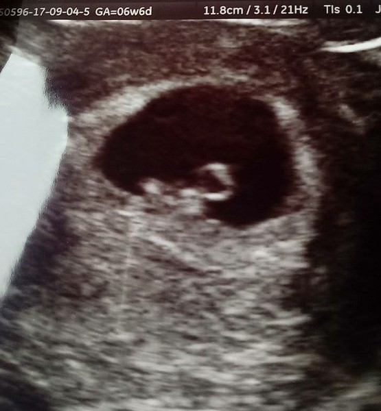 Babies due in April 2018