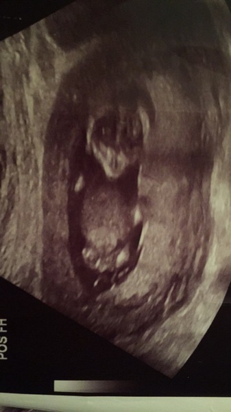 Thread no.2 for babies due April 2018