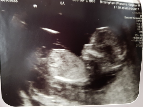 Nub pics help!!! (Gender)
