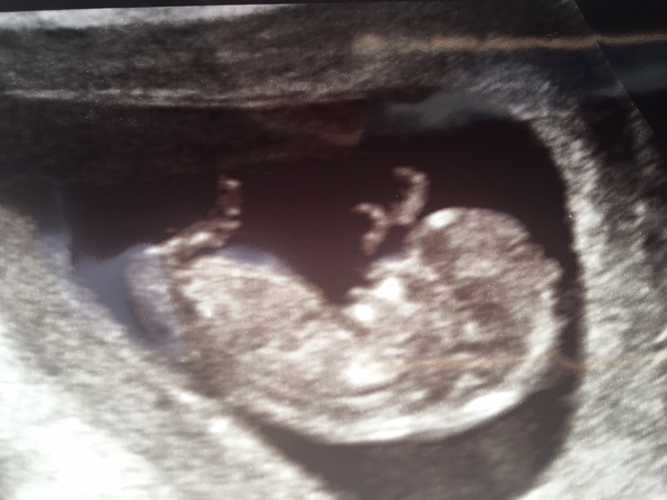 Pregnancies due April 2018 *Edited by MNHQ*