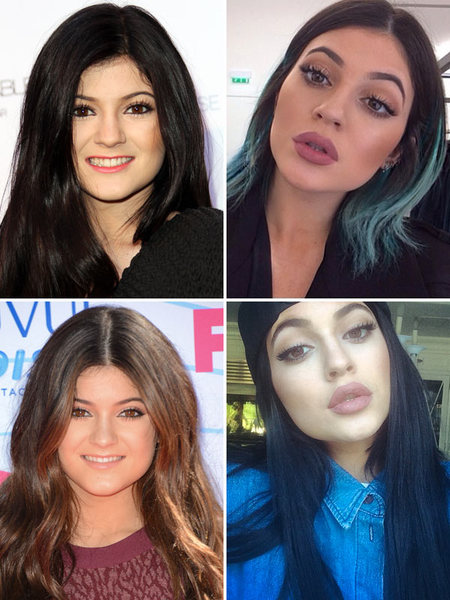 So I have booked in to have lip filler :terrified: