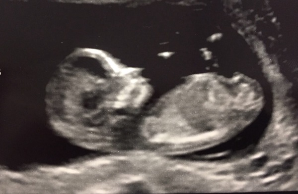 March 2018 (Part Four)