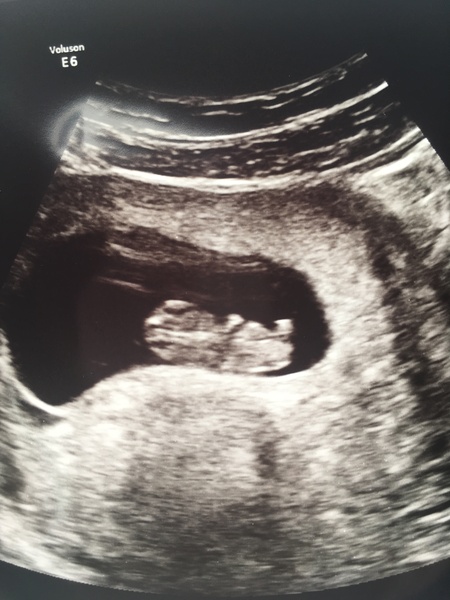 Babies due in April 2018