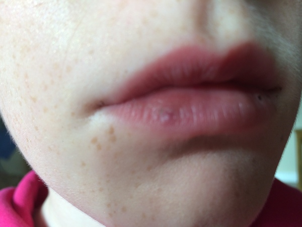 Spot on DD's lip