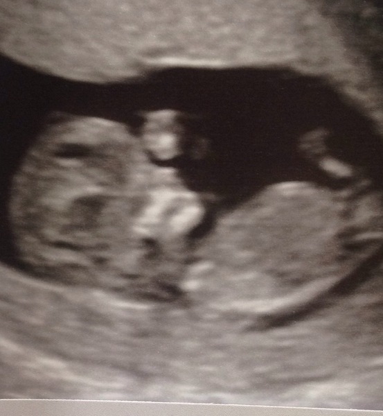 March 2018 (Part Four)