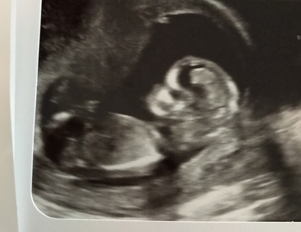 March 2018 (Part Four)