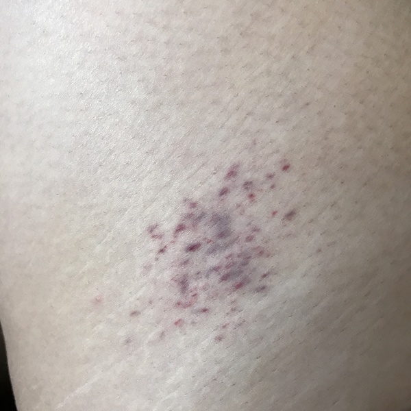 What's this on my leg?