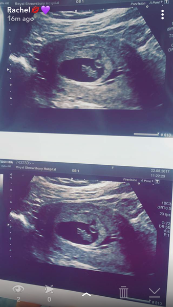 Pregnancies due April 2018 *Edited by MNHQ*