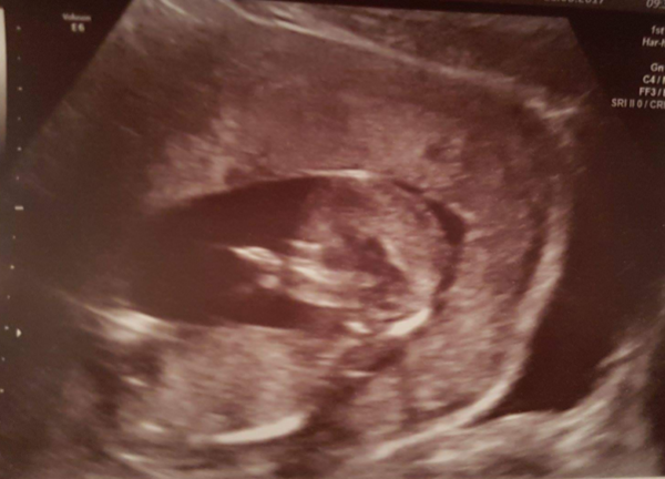 Scan pic, boy or girl?