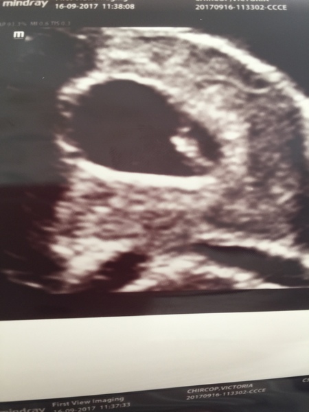 Thread no.2 for babies due April 2018