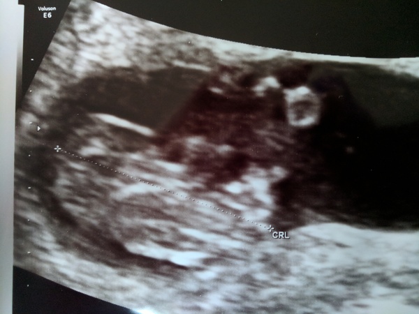 Pregnancies due April 2018 *Edited by MNHQ*