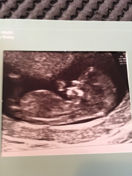 Thread no.2 for babies due April 2018