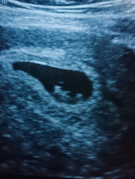 Babies due in April 2018