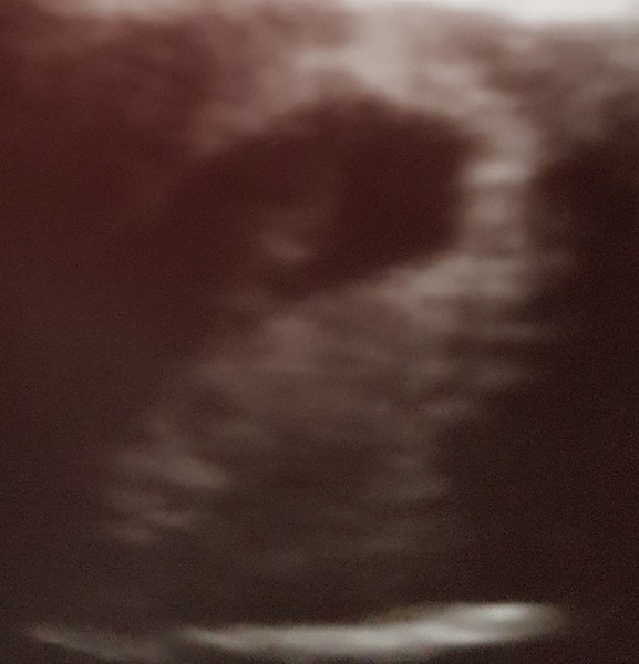 Pregnancies due April 2018 *Edited by MNHQ*