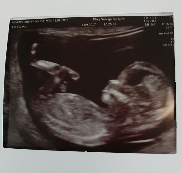 March 2018 (Part Four)