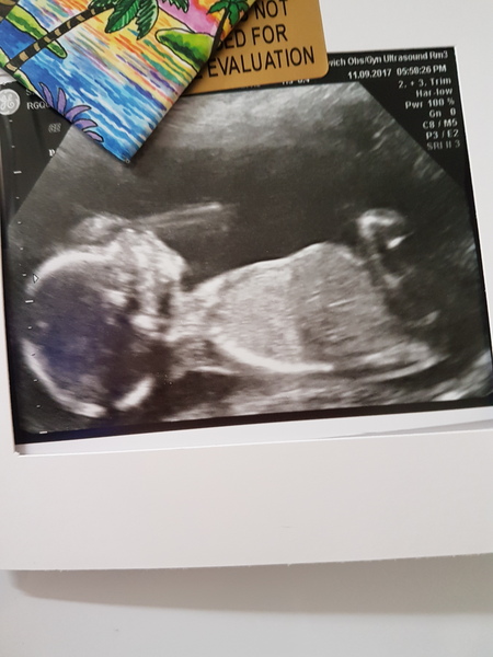 January Babies #5 - Are we 'glowing' yet?!