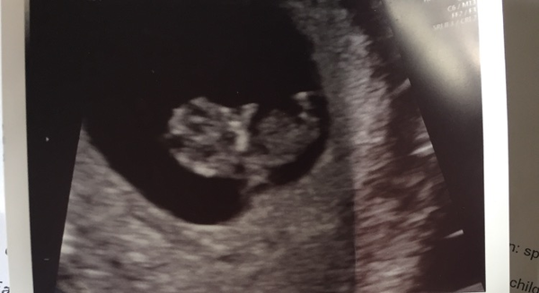Pregnancies due April 2018 *Edited by MNHQ*