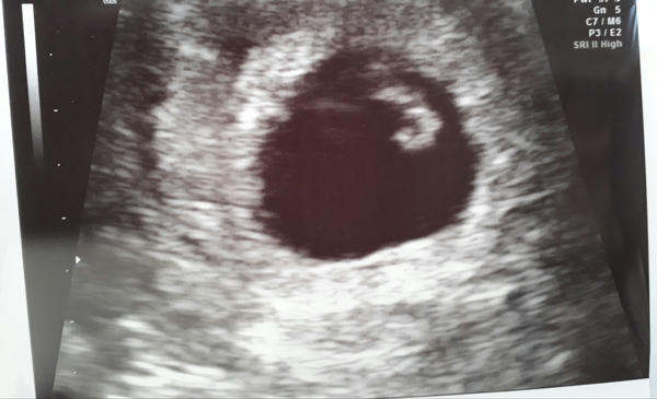 Babies due in April 2018