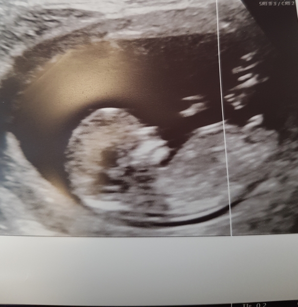 Any guesses on baby's sex?