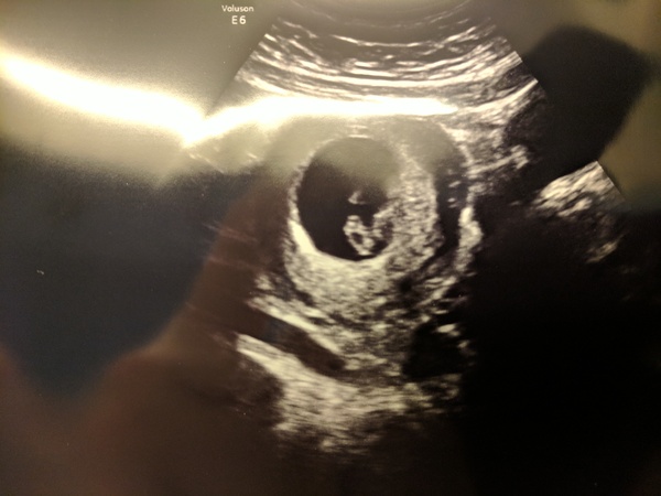 Pregnancies due April 2018 *Edited by MNHQ*