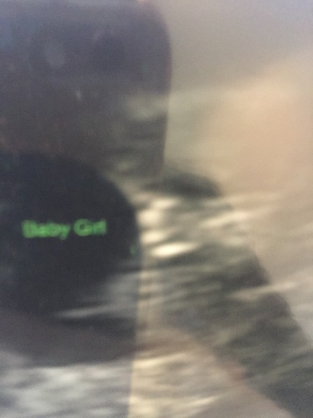 Potty shot? Worried sexing scan was wrong.