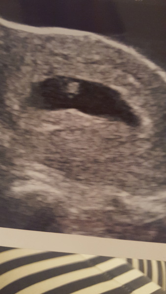 Pregnancies due April 2018 *Edited by MNHQ*